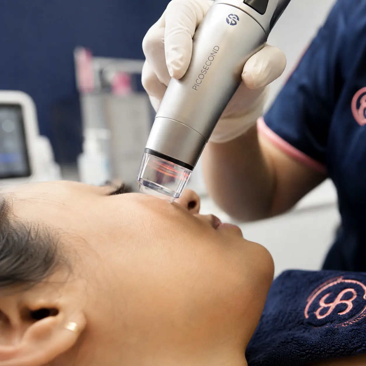 Close-up of a Pico laser handpiece being used during a pigmentation treatment session at Smart Surgeons Trivandrum